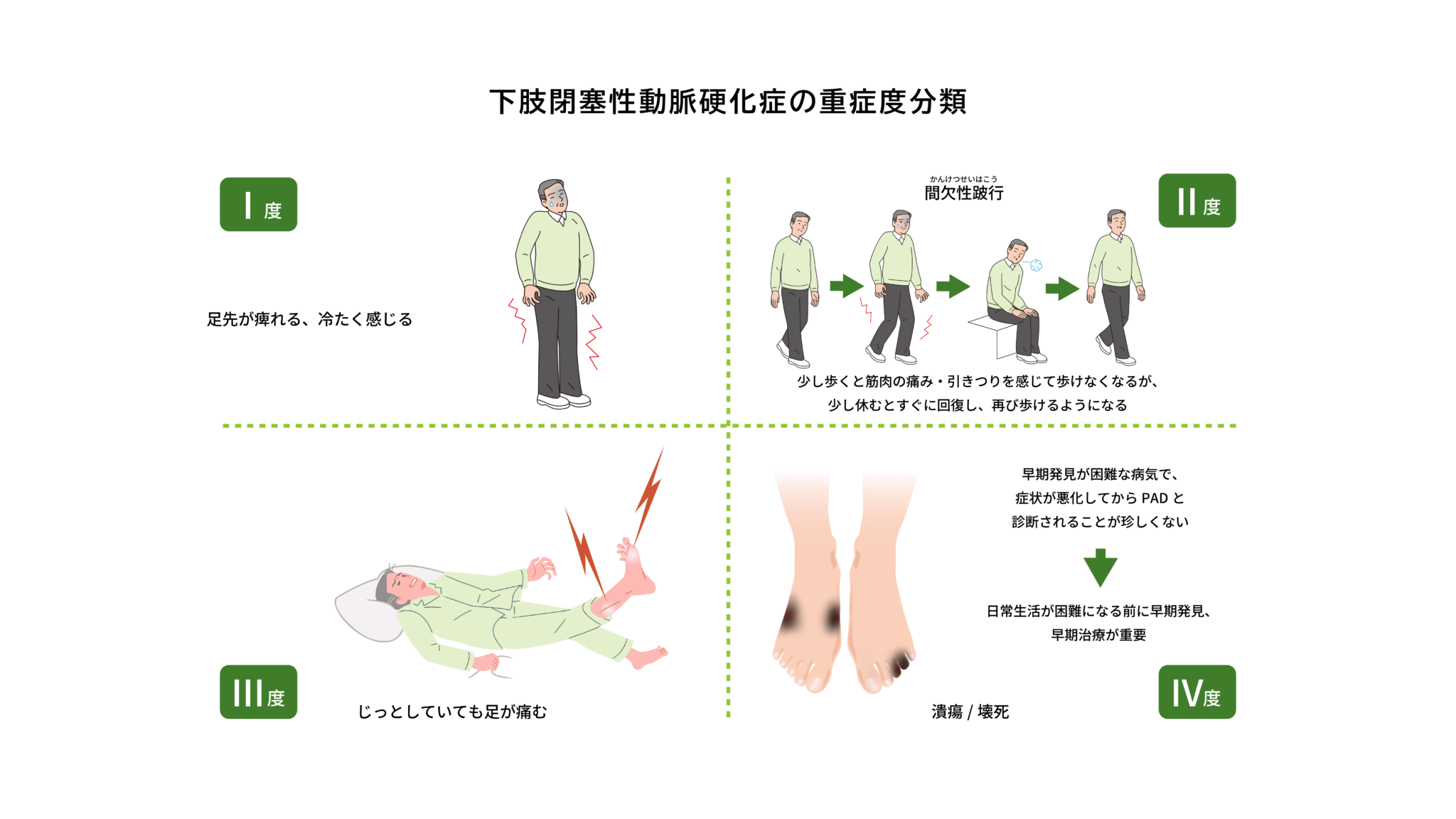 Von Recklinghausen病に合併した血胸の一手術例 – PFWISM